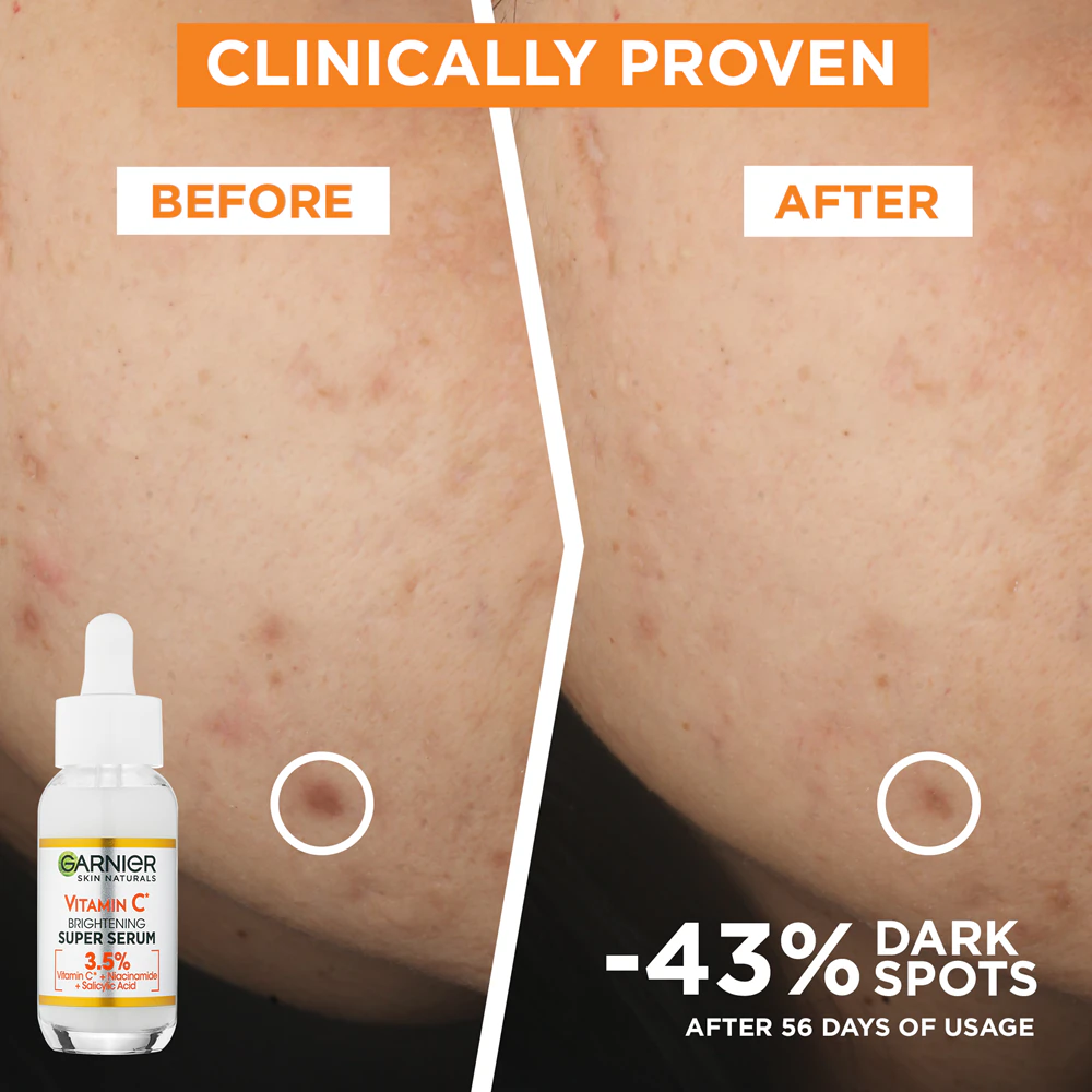 Garnier Skin Naturals Super Sérum pour les décolorations à la vitamine C 30ml
